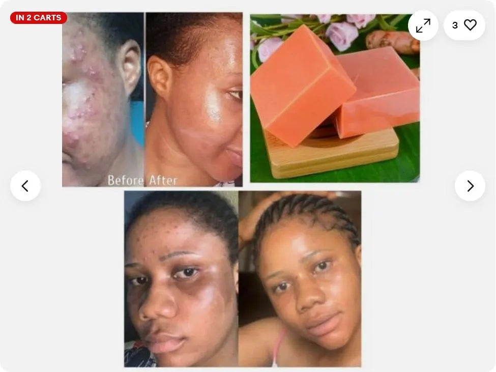 6pcs Natural Turmeric Soap Bars