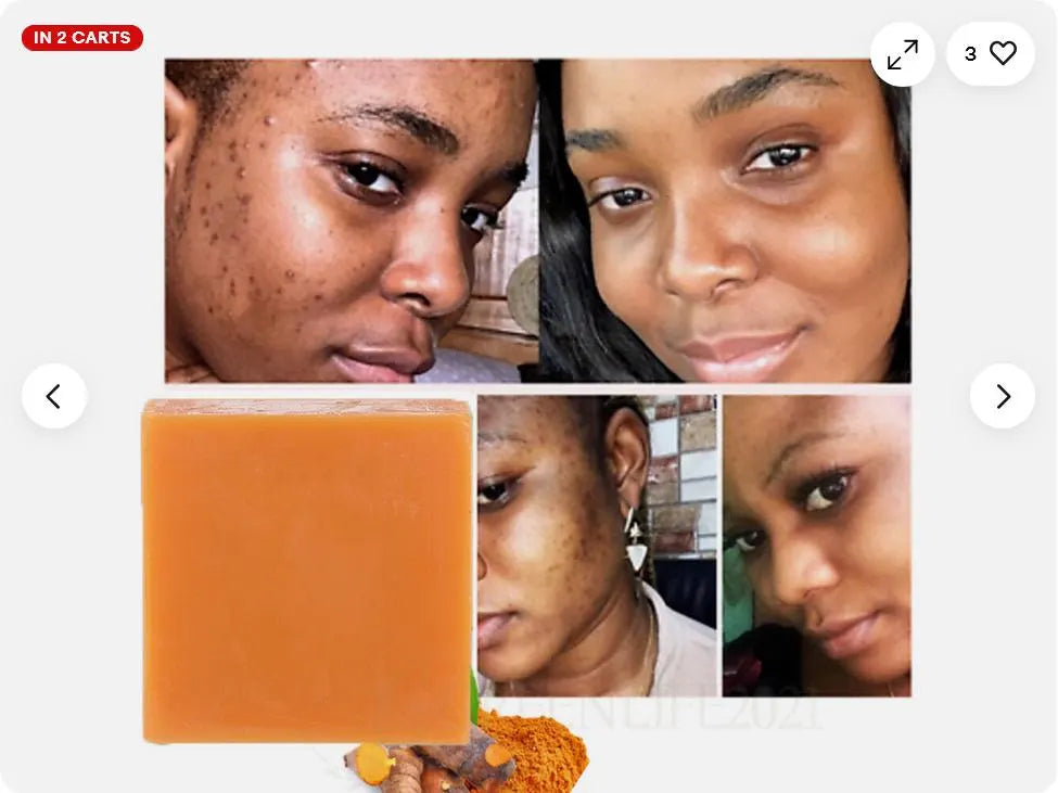 2pcs Natural Turmeric Soap Bars